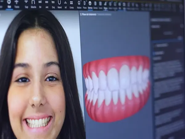 Simulação IA do sorriso